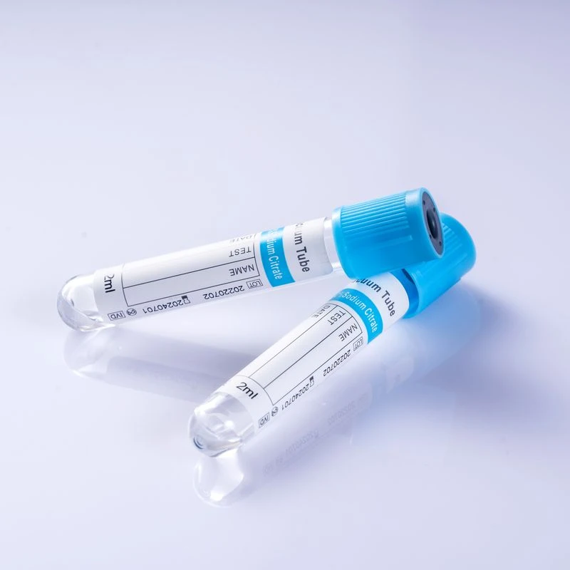 3.2/3.8% Sodium Citrate Coagulation Tube 9:1 Light Blue Cap